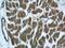 Peroxisome Proliferator Activated Receptor Gamma antibody, 16643-1-AP, Proteintech Group, Immunohistochemistry paraffin image 