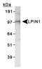 Lipin 1 antibody, PA1-16997, Invitrogen Antibodies, Western Blot image 