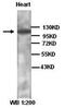 Catenin Alpha 3 antibody, orb77053, Biorbyt, Western Blot image 