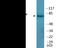 Microtubule Associated Protein Tau antibody, EKC2531, Boster Biological Technology, Western Blot image 