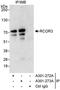 REST corepressor 3 antibody, A301-272A, Bethyl Labs, Immunoprecipitation image 