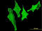 Pim-1 Proto-Oncogene, Serine/Threonine Kinase antibody, LS-B6063, Lifespan Biosciences, Immunofluorescence image 
