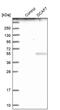 DDB1 And CUL4 Associated Factor 7 antibody, PA5-54647, Invitrogen Antibodies, Western Blot image 