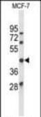 Ataxin 3 antibody, PA5-26251, Invitrogen Antibodies, Western Blot image 