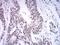 SET1 antibody, NBP2-61685, Novus Biologicals, Immunohistochemistry paraffin image 