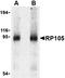 CD180 Molecule antibody, orb74730, Biorbyt, Western Blot image 
