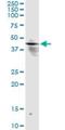 Inositol Polyphosphate-1-Phosphatase antibody, H00003628-M14, Novus Biologicals, Immunoprecipitation image 