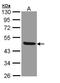 Interleukin 1 Receptor Type 2 antibody, GTX108702, GeneTex, Western Blot image 