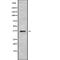 Melanoma-associated antigen 4 antibody, abx216655, Abbexa, Western Blot image 