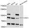 Dynein Axonemal Intermediate Chain 1 antibody, STJ114024, St John