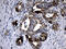 Propionyl-CoA Carboxylase Subunit Alpha antibody, M03395, Boster Biological Technology, Immunohistochemistry paraffin image 