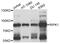 Receptor Interacting Serine/Threonine Kinase 1 antibody, abx007191, Abbexa, Western Blot image 