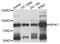 Receptor-interacting serine/threonine-protein kinase 1 antibody, abx007191, Abbexa, Western Blot image 