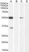 Potassium Calcium-Activated Channel Subfamily N Member 4 antibody, LS-B5138, Lifespan Biosciences, Western Blot image 
