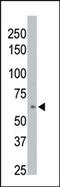 Protein Phosphatase, Mg2+/Mn2+ Dependent 1D antibody, AP15251PU-N, Origene, Western Blot image 