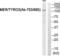 MER Proto-Oncogene, Tyrosine Kinase antibody, abx013011, Abbexa, Western Blot image 