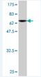 DnaJ Heat Shock Protein Family (Hsp40) Member A2 antibody, H00010294-M03, Novus Biologicals, Western Blot image 