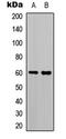 Transcription Factor 4 antibody, LS-C358353, Lifespan Biosciences, Western Blot image 