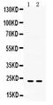 Insulin Like Growth Factor Binding Protein 5 antibody, PB9711, Boster Biological Technology, Western Blot image 