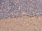 Chromosome 17 Open Reading Frame 75 antibody, NBP1-33006, Novus Biologicals, Immunohistochemistry paraffin image 