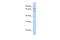 Zinc Finger Protein 691 antibody, A15223, Boster Biological Technology, Western Blot image 