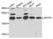 Centromere Protein S antibody, A8293, ABclonal Technology, Western Blot image 