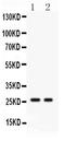 Kallikrein Related Peptidase 4 antibody, PB9260, Boster Biological Technology, Western Blot image 