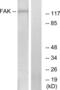 Protein Tyrosine Kinase 2 antibody, LS-C118116, Lifespan Biosciences, Western Blot image 