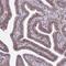 Tetraspanin 15 antibody, NBP1-92540, Novus Biologicals, Immunohistochemistry paraffin image 