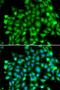 SUFU Negative Regulator Of Hedgehog Signaling antibody, LS-C334926, Lifespan Biosciences, Immunofluorescence image 