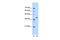 Enoyl-CoA Hydratase Domain Containing 3 antibody, GTX46168, GeneTex, Western Blot image 