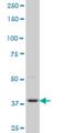 PDZ Binding Kinase antibody, H00055872-M06, Novus Biologicals, Western Blot image 