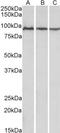 Aconitase 2 antibody, NBP1-52015, Novus Biologicals, Western Blot image 