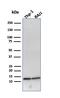 Beta-2-Microglobulin antibody, GTX34437, GeneTex, Western Blot image 