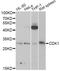Cyclin Dependent Kinase 1 antibody, LS-C746813, Lifespan Biosciences, Western Blot image 