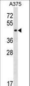 SGT1 Homolog, MIS12 Kinetochore Complex Assembly Cochaperone antibody, LS-C157112, Lifespan Biosciences, Western Blot image 