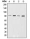 G Protein-Coupled Receptor Kinase 2 antibody, MBS820940, MyBioSource, Western Blot image 