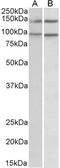 Rho/Rac Guanine Nucleotide Exchange Factor 18 antibody, LS-C55221, Lifespan Biosciences, Western Blot image 