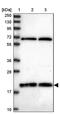 Ring Finger Protein 181 antibody, PA5-61153, Invitrogen Antibodies, Western Blot image 