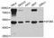 Splicing Factor 3b Subunit 4 antibody, A4394, ABclonal Technology, Western Blot image 