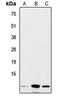 Insulin antibody, LS-C353795, Lifespan Biosciences, Western Blot image 