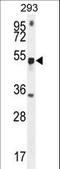 Methyltransferase Like 4 antibody, LS-C164157, Lifespan Biosciences, Western Blot image 
