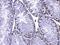 Mediator Complex Subunit 8 antibody, A08094-1, Boster Biological Technology, Immunohistochemistry frozen image 