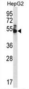 Diphthamide Biosynthesis 7 antibody, AP54555PU-N, Origene, Western Blot image 