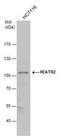 Dynein Axonemal Assembly Factor 5 antibody, PA5-35890, Invitrogen Antibodies, Western Blot image 