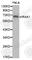 Interleukin 1 Receptor Associated Kinase 1 antibody, A0893, ABclonal Technology, Western Blot image 