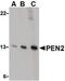 Presenilin Enhancer, Gamma-Secretase Subunit antibody, PA5-20301, Invitrogen Antibodies, Western Blot image 