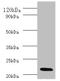 Interferon Alpha 2 antibody, LS-B13067, Lifespan Biosciences, Western Blot image 