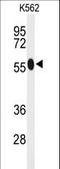 Acyl-CoA Synthetase Medium Chain Family Member 1 antibody, LS-C155976, Lifespan Biosciences, Western Blot image 