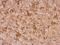 Myosin Heavy Chain 9 antibody, GTX633295, GeneTex, Immunohistochemistry paraffin image 